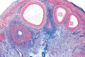 Ovary, cross-section, microscope slide