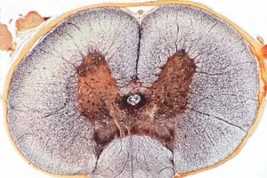Microscope slide spinal cord of cat, t.s.