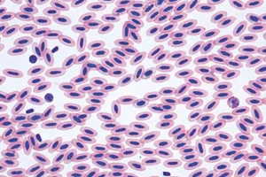 Slide chicken, blood smear